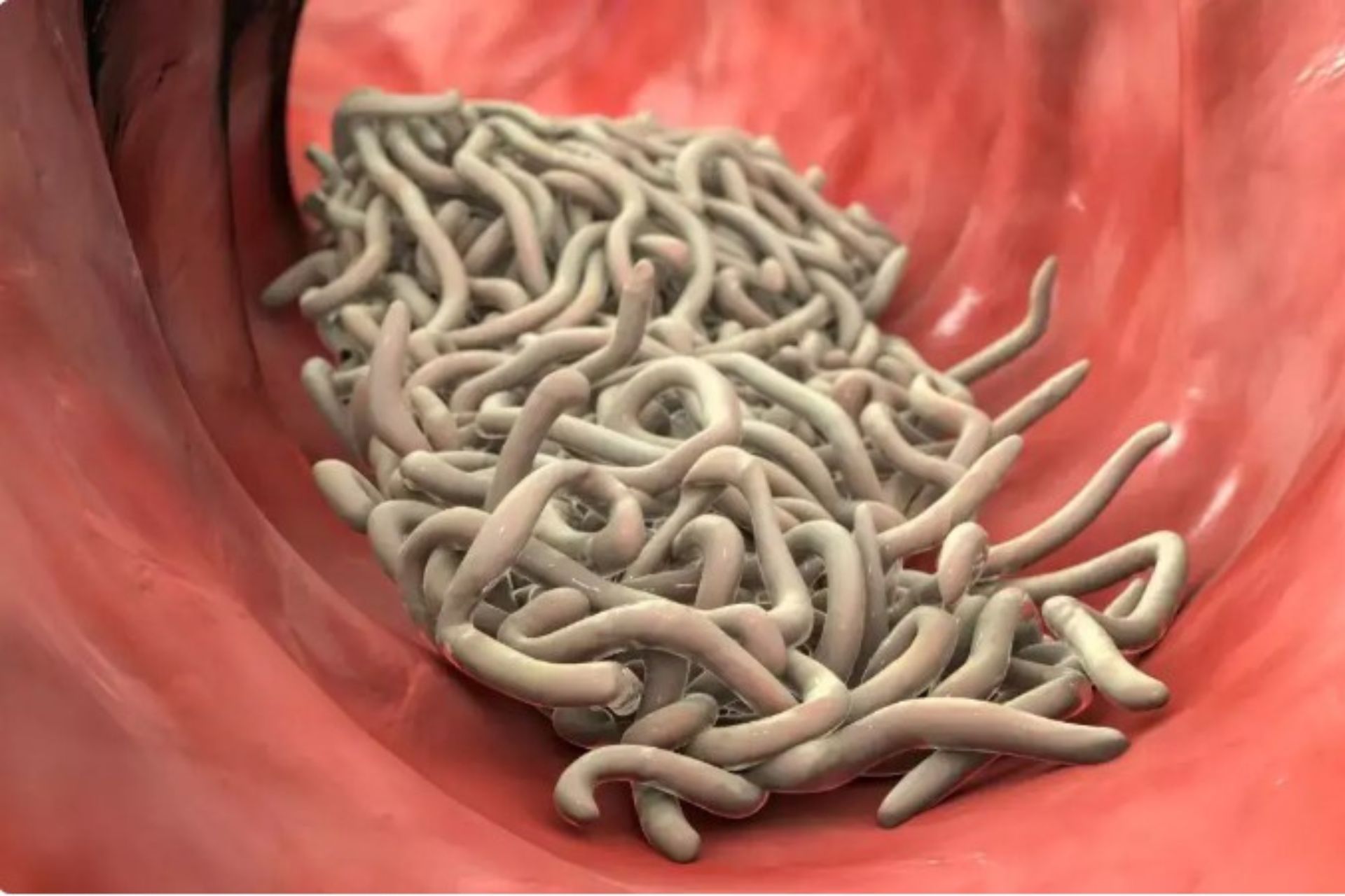 বড়দের কৃমি দূর করার উপায়